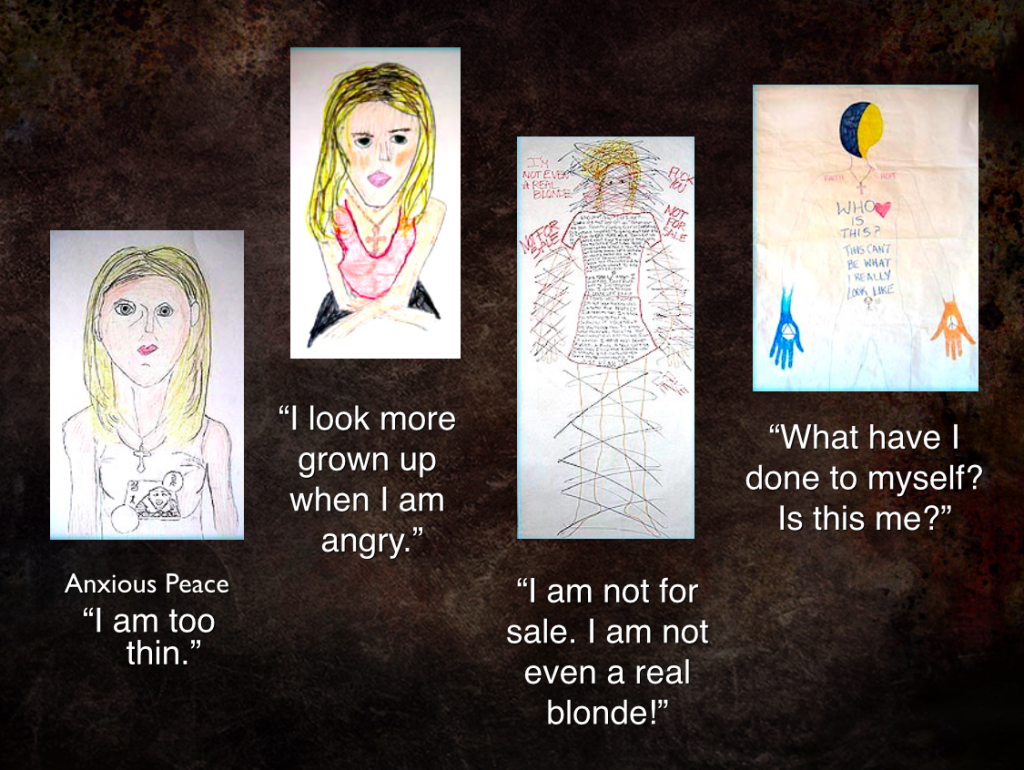 Anorexia, Body-Image Dysphoria, and Art Therapy - Art Speaks Out Loud